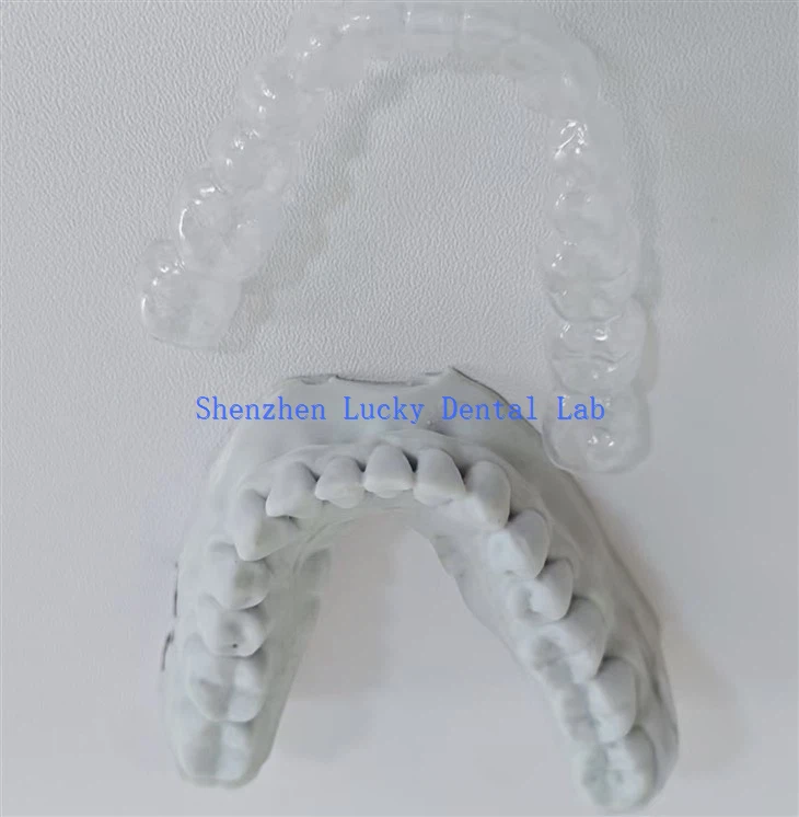 Aesthetic 3D Print Clear Retainer Dental Lab