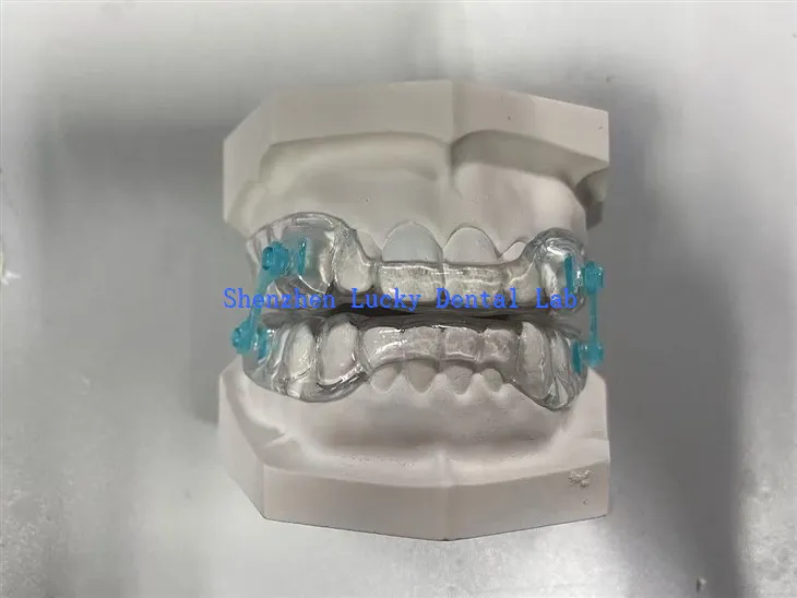 Dispositivo anti -ronquido de alta calidad