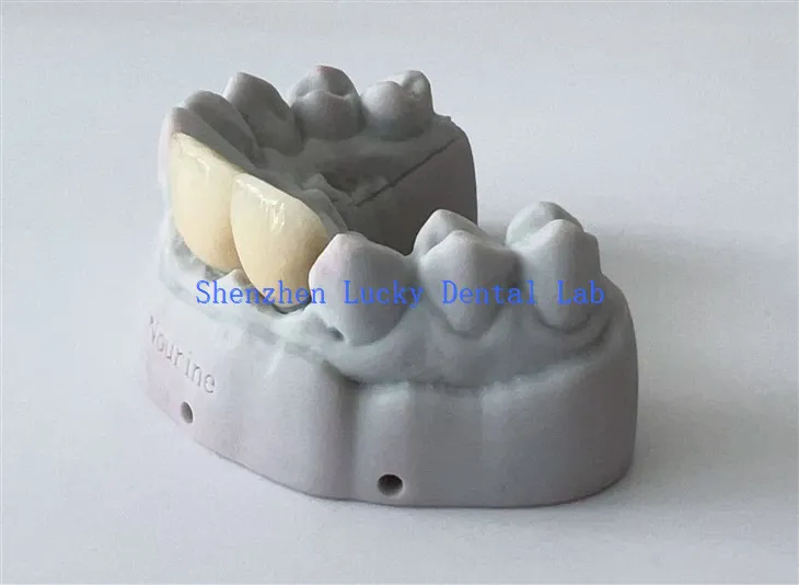 China impresa 3D dental pfm cuocr corona