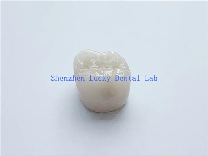 China Dental PFM COCR COCR CROWN NINGUNA METAL DE METAL