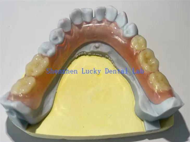 Fabricantes de dentaduras dentales flexibles y flexibles parciales parciales