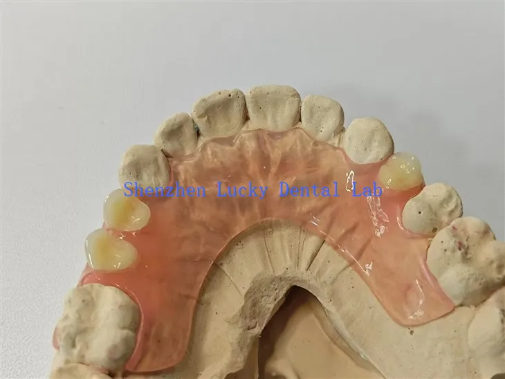 Laboratorio dental de dentadura postiza flexible y flexible