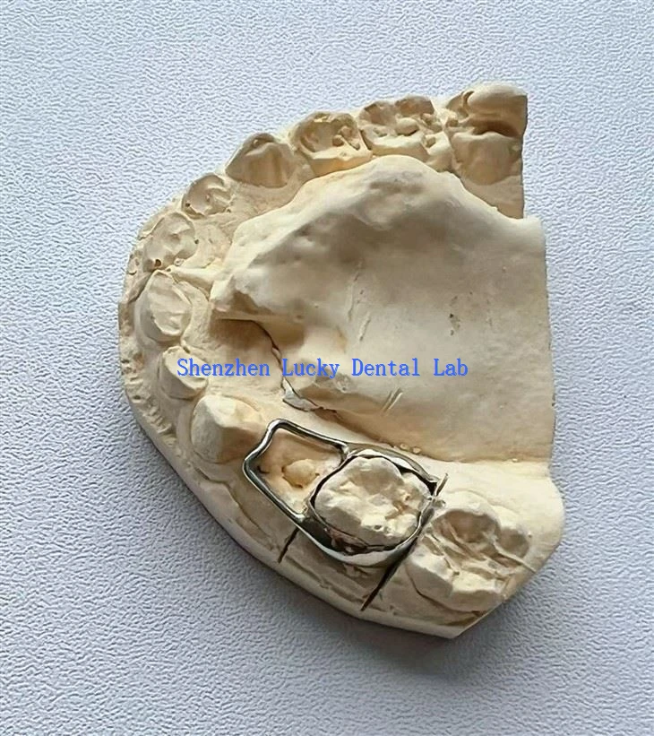Customized Space Retainer Made in China