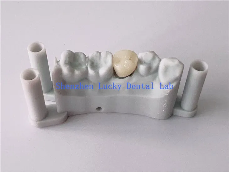 Laboratorio dental de Crown Dental Crown Crown Crown Crown Crown Crown Crown.