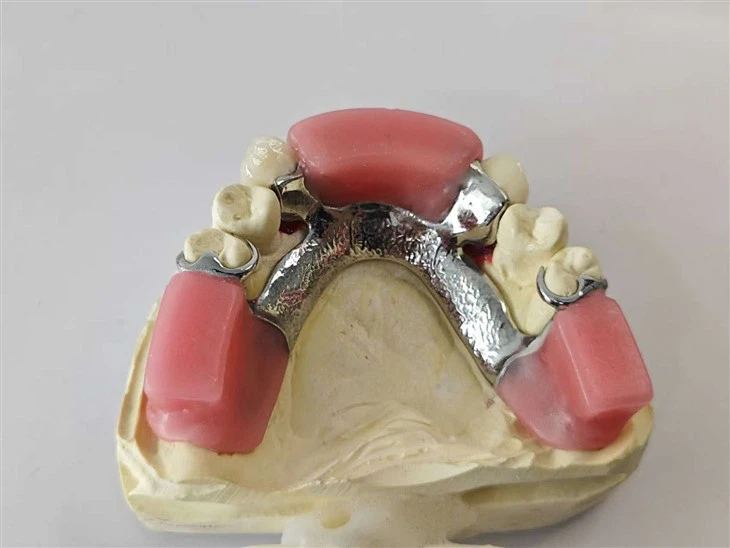 Atacamiento de precisión dental del canal de perno con marco de metal y bloque de mordedura