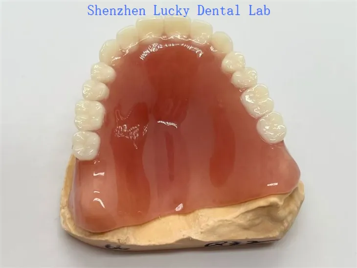 Dentadura postiza acrílica completa con goma Meharry
