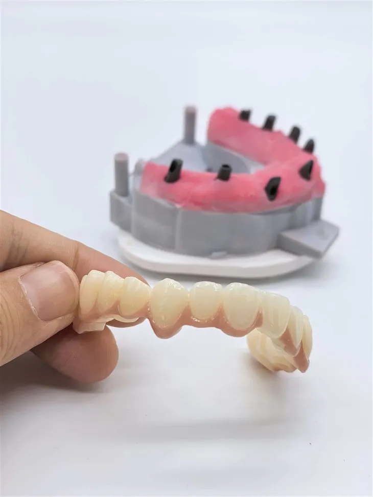 Implante completo de circonio atornillado-con goma de porcelana