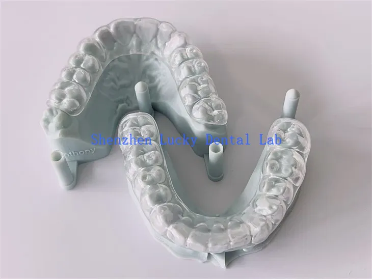 Hard Occlusal Night Guard Laboratorio dental