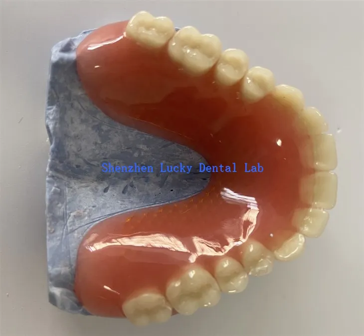 Dentadura postiza completa de alta calidad con fábrica de malla de metal