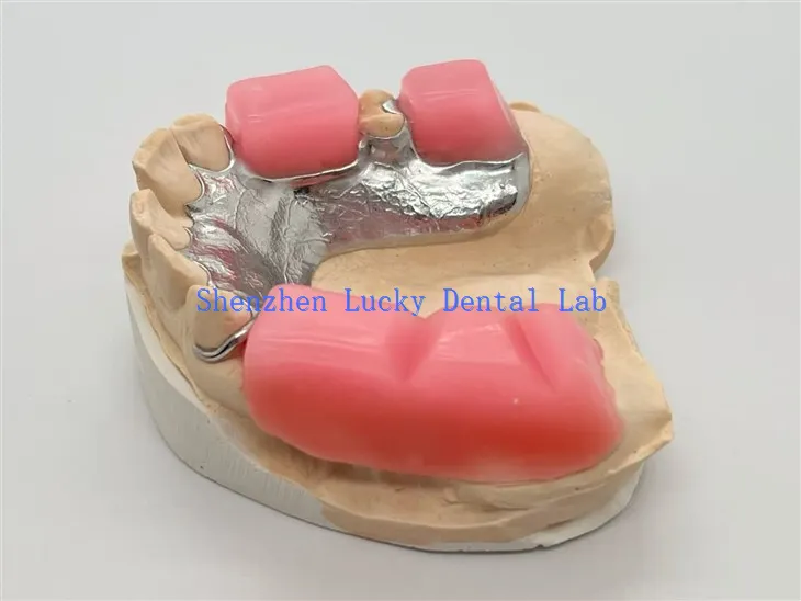 Estructura de metal con bloque de mordida.