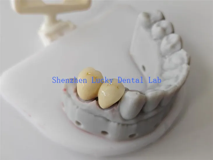 Laboratorio dental de curown dental de impresión 3D natural COCR COCR COCRO