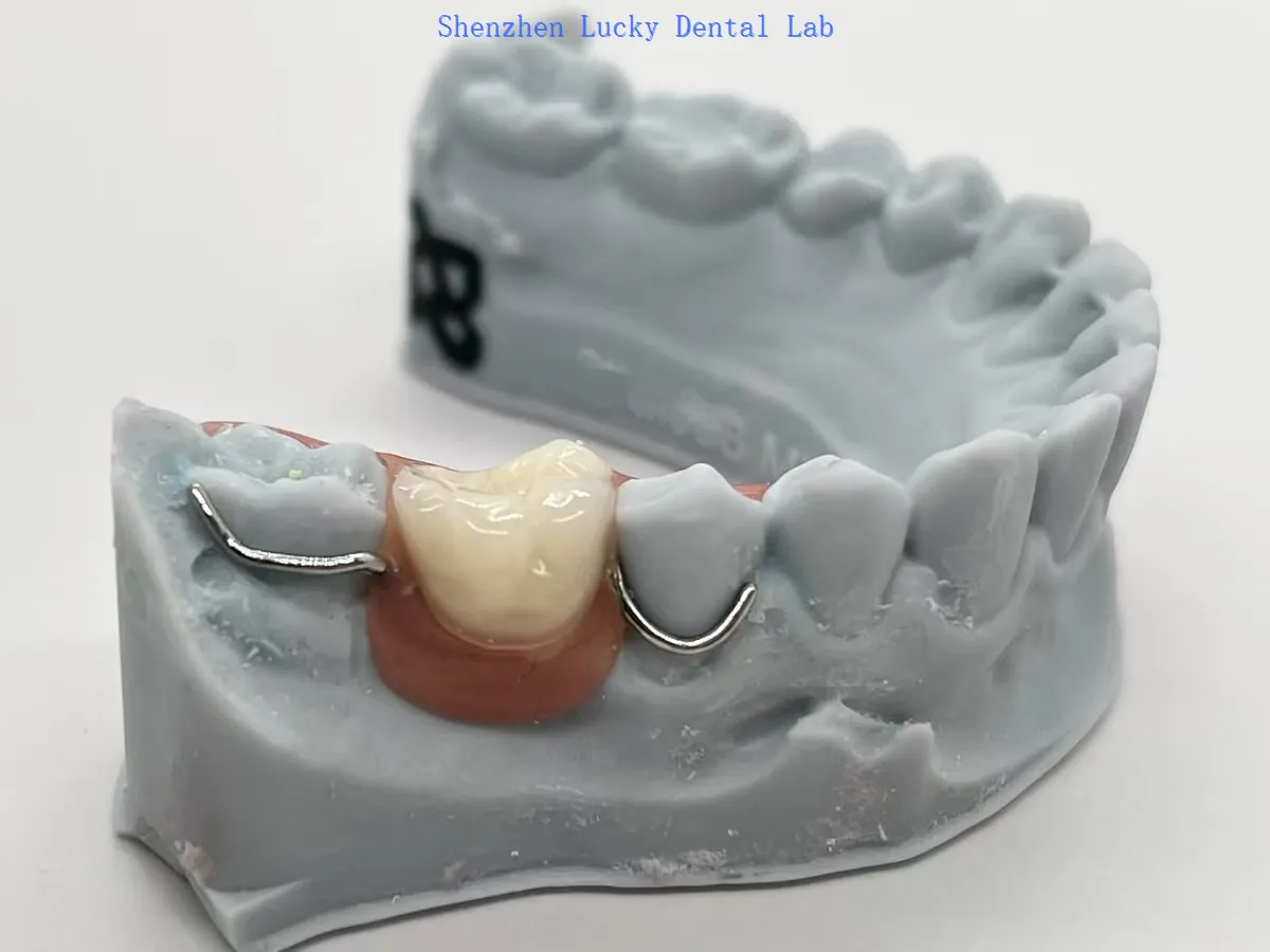 2025102117465428957 2025102117465428957