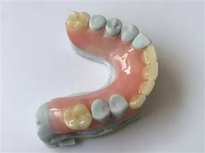 Dentadura flexible parcial parcial parcial parcial dental de impresión 3D personalizada de China