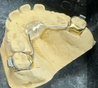 Fábrica de retenedores de China Nance