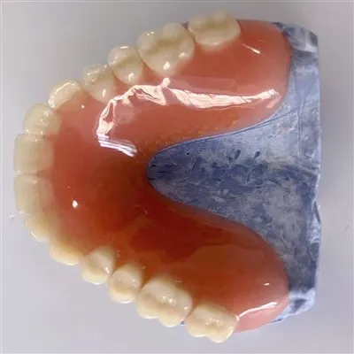 Malla de metal personalizada dentada dental acrílica completa hecha en China